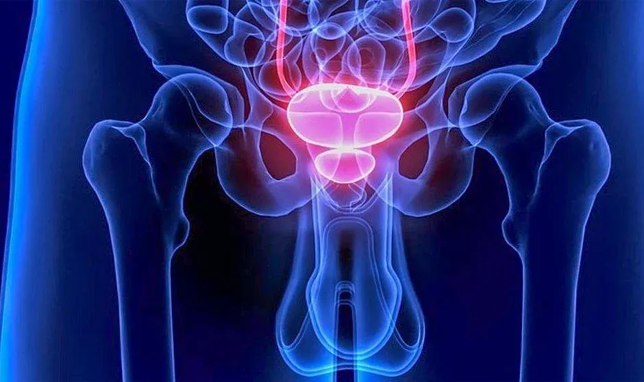 Imagen de referencia para Enfermedades urologicas masculinas