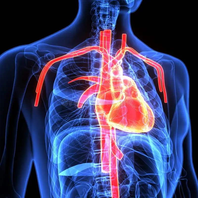 Imagen de referencia para Enfermedades cardiovasculares