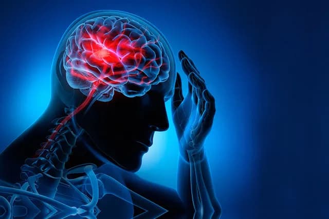 Imagen de referencia para Trastornos neurologicos